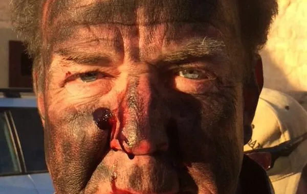 Jeremy Clarkson, ferito durante le riprese del nuovo show